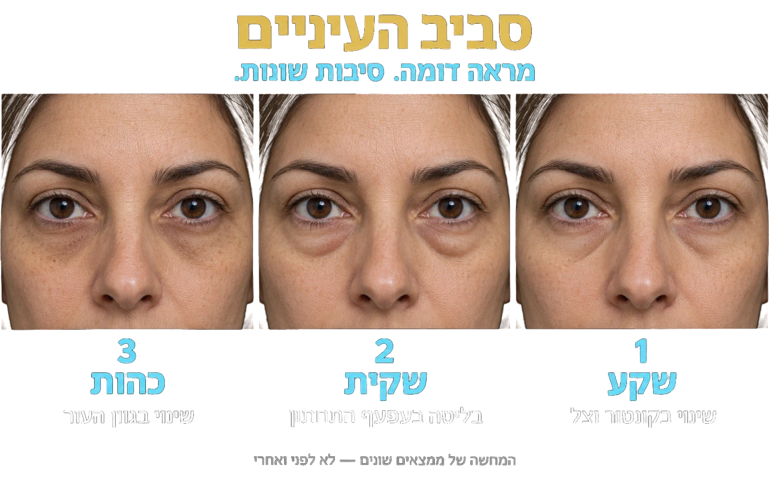 מימין לשמאל: שקע, שקית וכהות — המחשות של ממצאים שונים, לא לפני ואחרי.