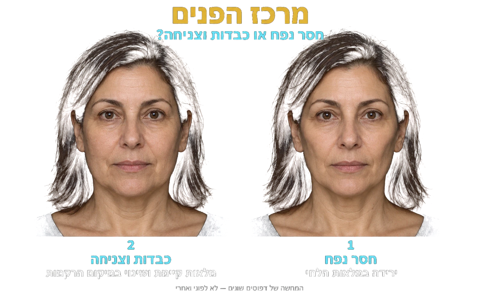 מימין: חסר נפח. משמאל: כבדות וצניחה. המחשת דפוסים שונים, לא לפני ואחרי.